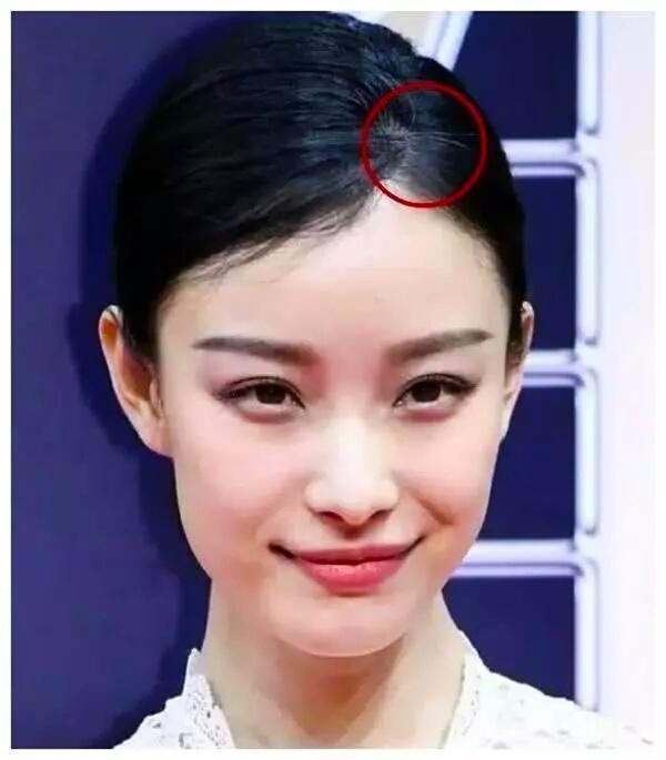 白头发多的女明星